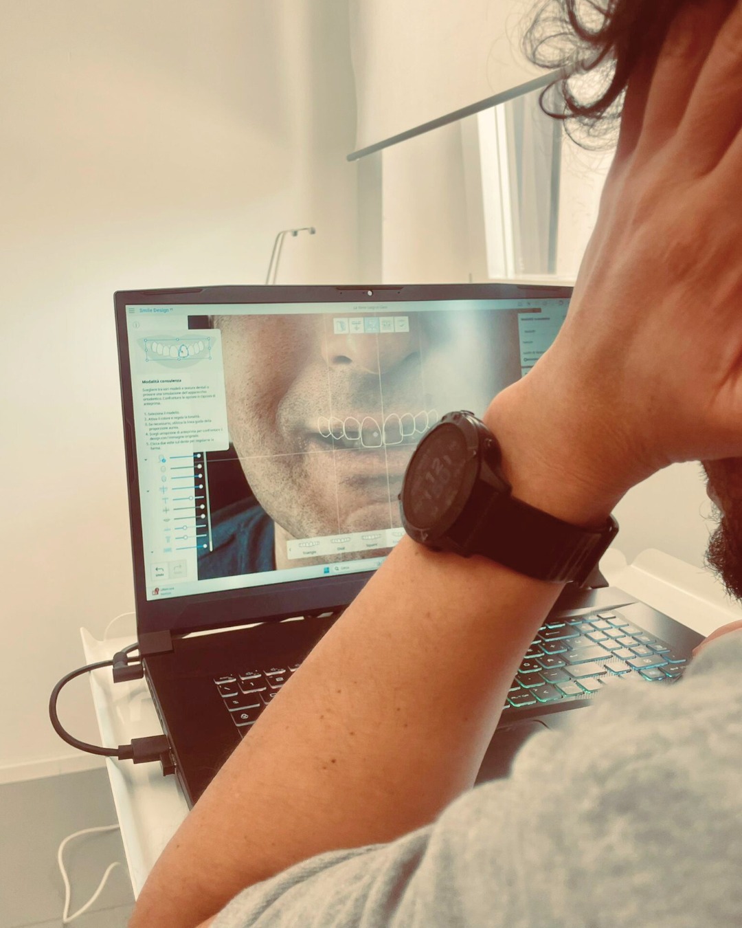 Endodonzia e devitalizzazione dente Manfredonia - cura canale radicolare Studio Di Bari