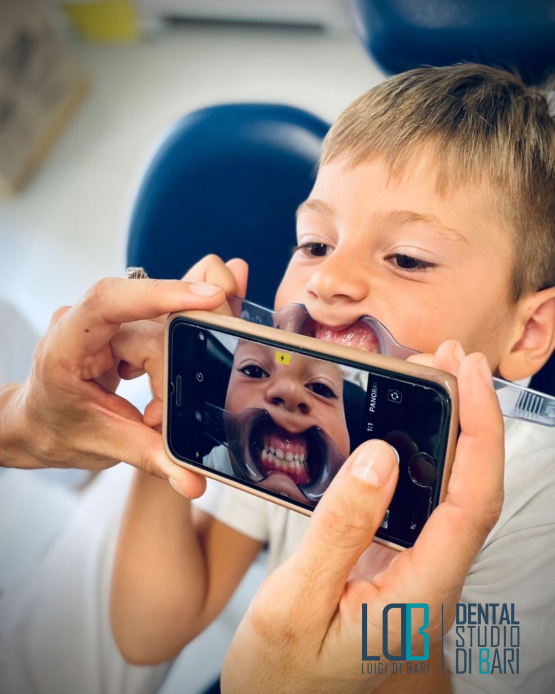 Protesi dentaria fissa e mobile Manfredonia - corone e ponti in ceramica Studio Di Bari